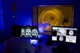 Foto: El flujo sanguíneo del cerebro disminuye en etapas asintomáticas del Alzheimer