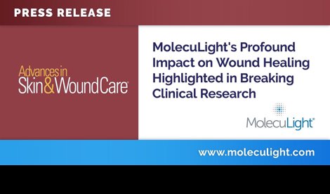 Comunicados Internacional