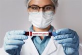 Foto: Solo la mitad de los españoles que iniciaron su vacunación contra mpox ha completado la pauta