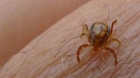 Andalucía confirma el caso de fiebre hemorrágica Crimea-Congo, ingresado estable en el Virgen del Rocío de Sevilla