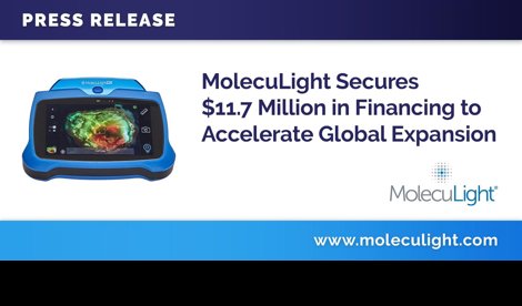 Comunicados Internacional