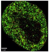 Foto: Desarrollan una IA que detecta el cáncer e infecciones virales con "precisión nanométrica"