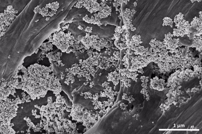 Imagen captada por microscopía electrónica de barrido donde se ve las nanoflores de óxido de hierro sobre microplásticos.