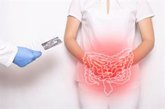 Foto: AbbVie anuncia que la CE ha aprobado risankizumab para tratar a adultos con colitis ulcerosa activa