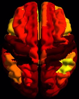 La imagen muestra la distribución jerárquica de conexiones representada en colores sobre la superficie de un cerebro humano. (Créditos: Cell Systems).