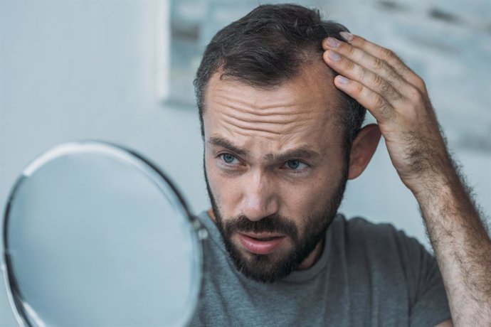 Archivo - Hombre mirándose al espejo, viendo si se le cae el cabello.