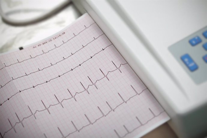 Archivo - Cardiología, fibrilación auricular