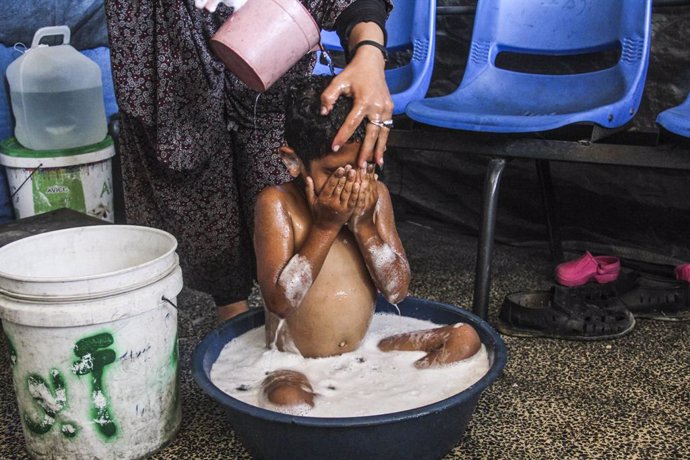 Archivo - GAZA, July 18, 2024  -- A child of Ahmed Shinbari takes a bath in the northern parts of Gaza, on July 17, 2024. About 67 percent of water, sanitation facilities and infrastructure have been destroyed or damaged in the Gaza Strip, the United Nati