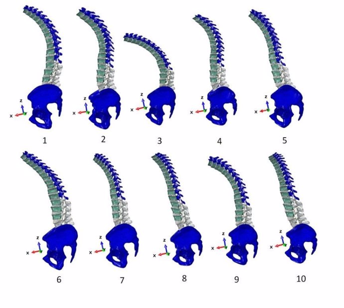 Imágenes de los primeros modelos personalizados de la parte toracolumbar de la columna vertebral