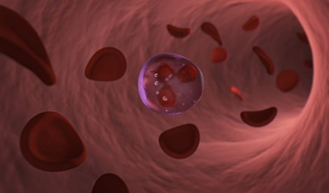 Investigación