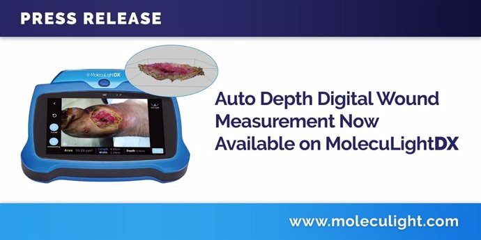 Auto Depth Digital Wound Measurement Now Available on MolecuLightDX (CNW Group/MolecuLight)