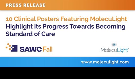 Comunicados Internacional