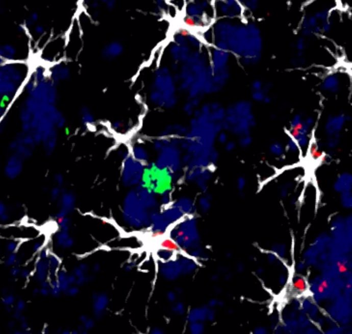 Células en torno a una metástasis cerebral en modelo animal