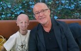 Foto: Fallece Sammy Basso, el paciente con progeria más longevo del mundo