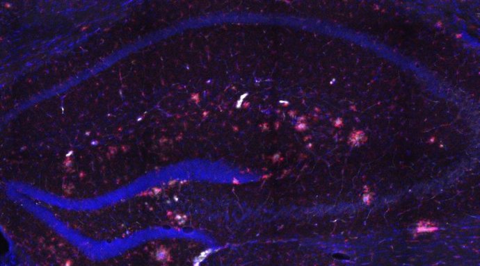 Archivo - La Fundación Pasqual Maragall financiará un estudio del CSIC-UMH sobre el sistema inmune y el Alzheimer