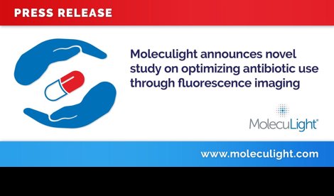 Comunicados Internacional