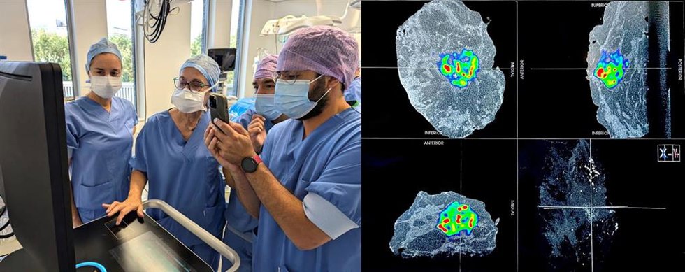 Un equipo del Clínico de Valncia se forma en el uso del PET-TC intraoperatorio para mejorar la precisión en la cirugía oncológica