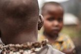 Foto: El mpox se ceba con los niños en África, aunque las lecciones aprendidas con la COVID-19 frenan su expansión