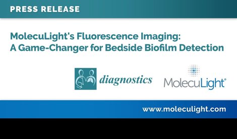 Comunicados Internacional