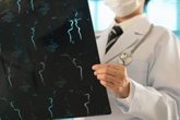 Foto: Hasta un 90% de los ictus se pueden evitar con hábitos saludables, según un experto