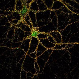 Neuronas de ratón modelo para la enfermedad Niemann Pick tipo C teñidas para el receptor metabotrópico total en verde o en superficie en rojo.