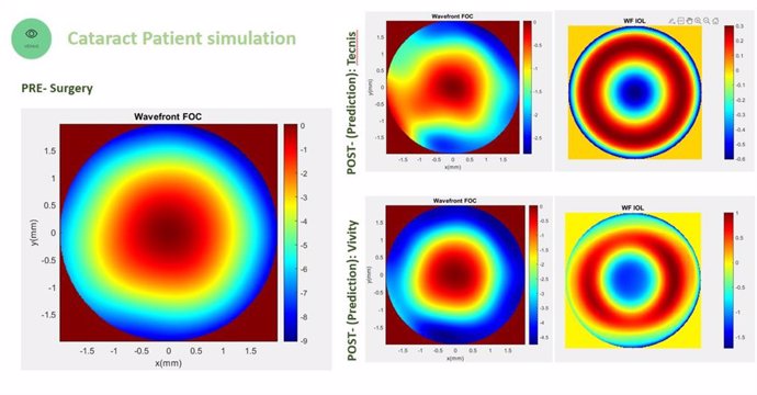 Resultados de la simulación de un caso de paciente de cataratas.