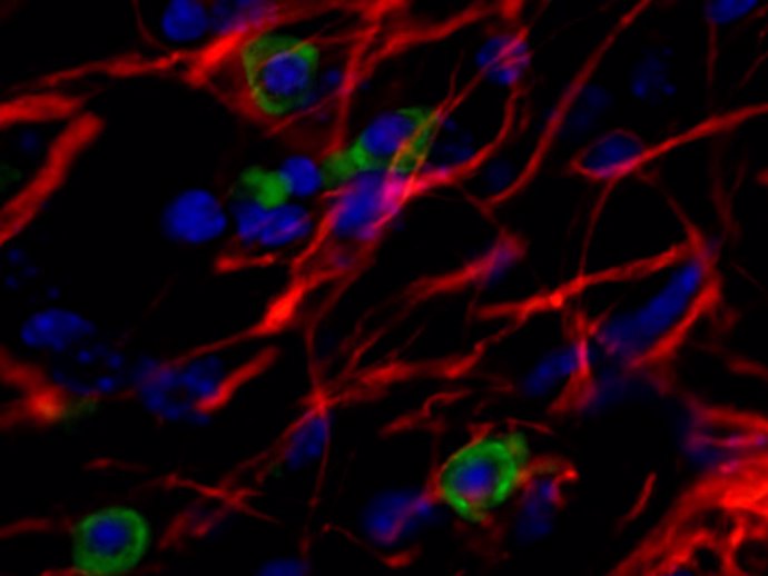 Imagen de células madre humanas trasplantadas en un modelo de ratón con Parkinson.