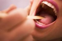Dentistas advierten de que los pacientes con VIH tienen más riesgo de sufrir patologías bucodentales como caries
