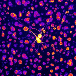 L'IRB detecta que la falta d'un segment de la proteïna CPEB4 disminueix l'expressió de gens crucials per al desenvolupament neuronal i l'associa a l'autisme idiopático