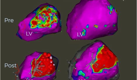 Comunicados Internacional