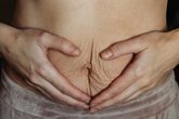 Foto: Hasta qué punto puedes hacer una vida normal con una diástasis abdominal