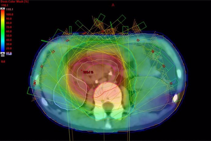 Imagen de recurso acerca de la investigación en cáncer infantil.