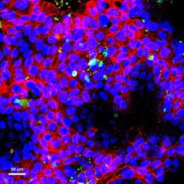 Las imágenes de microscopía muestran la capacidad de los nanoplásticos para interactuar con las células intestinales. Celular en azul y la membrana celular en rojo