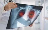 Foto: Un nuevo método de escaneo revela secretos de la función pulmonar