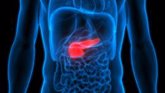 Foto: Identifican enzima que promueve el crecimiento y la propagación de tumores en el cáncer de páncreas
