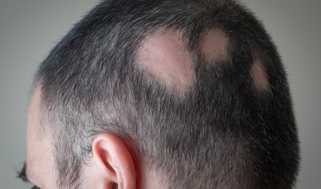 Estética