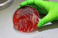 Un equipo del CSIC analiza por primera vez a gran escala cómo se adapta la bacteria del estafilococo en humanos