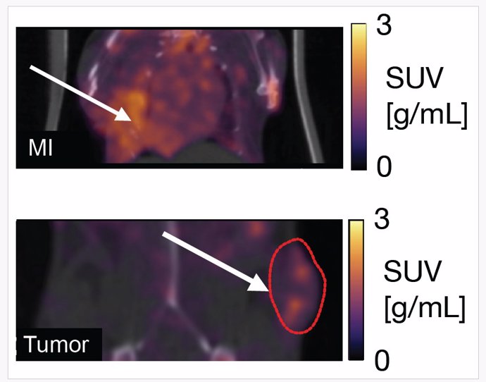 Imágenes PET in vivo que muestran acumulación de la sonda en el infarto (MI, arriba) y en el tumor (abajo).