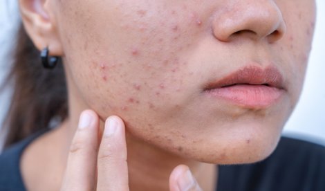 Estética