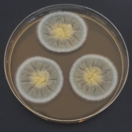 Archivo - Imagen de archivo de la fotografía de un hongo del tipo 'Aspergillus'.