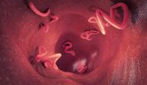 Foto: La EMA aprueba una nueva combinación de medicamentos para tratar las infecciones parasitarias por gusanos