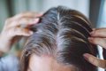 ¿El fin de las canas? La clave para evitarlas podría estar en el apio y el brócoli