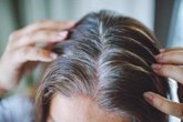 Foto: ¿Adiós a las canas? Científicos consiguen evitarlas en ratones