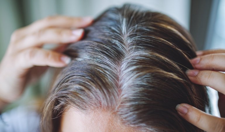 Estética
