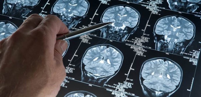 Archivo - Arquivo - O envelhecimento e as doenças neurodegenerativas estão associados ao aumento da inflamação cerebral e à diminuição das Tregs.