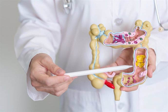 Archivo - El aumento de la incidencia de la colitis ulcerosa o de la enfermedad de Crohn podría explicarse por la alimentación