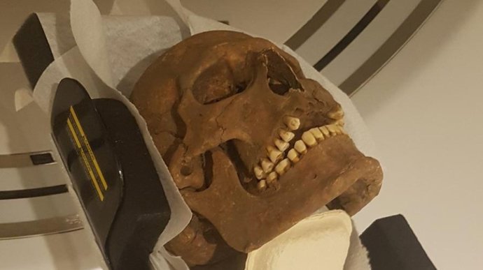 Os crânios de indivíduos da época dos vikings foram examinados com a moderna tomografia computadorizada, em busca de infecções, inflamações e outras doenças.