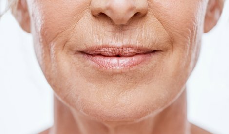 Estética