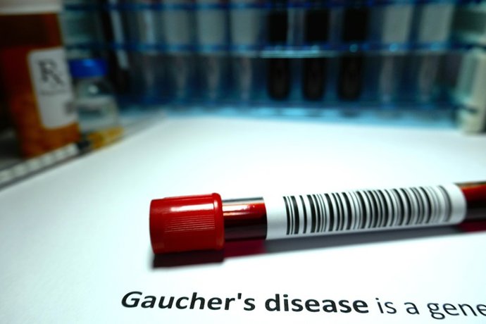 Archivo - Arquivo - Doença de Gaucher