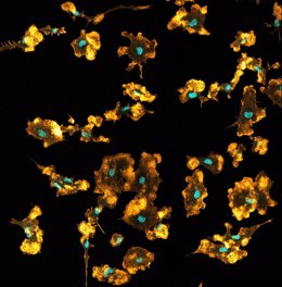 Archivo - Macrófagos de ratón visualizados en imagen de microscopio confocal. Los núcleos se ven en azul y la red de actina en naranja.